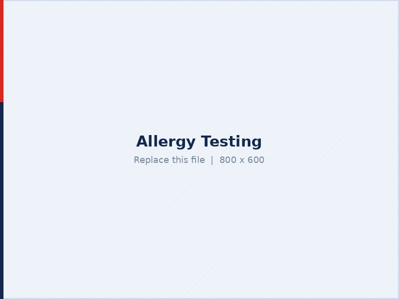 Allergy testing service