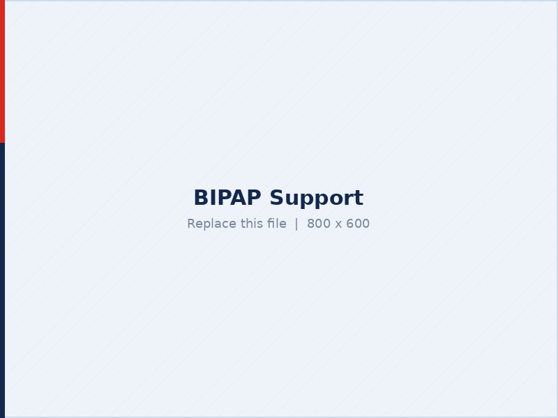 BIPAP non invasive ventilation