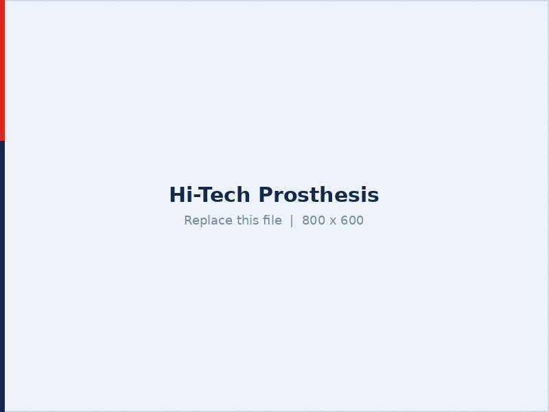 Artificial limb and prosthetics centre in Veraval, Gujarat